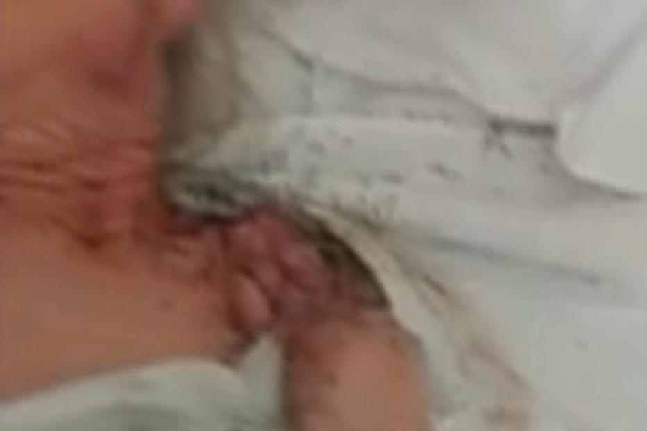 Idosa coberta de formigas