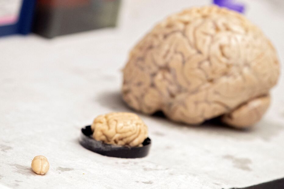 demência e alzheimer