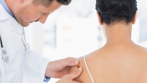 Nova técnica contra o cancro de pele aplicada em Portugal