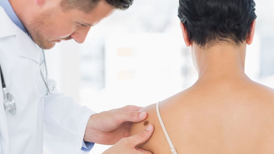 Cancro da pele em 30% a 40% dos casos apresenta resistência a técnicas atuais