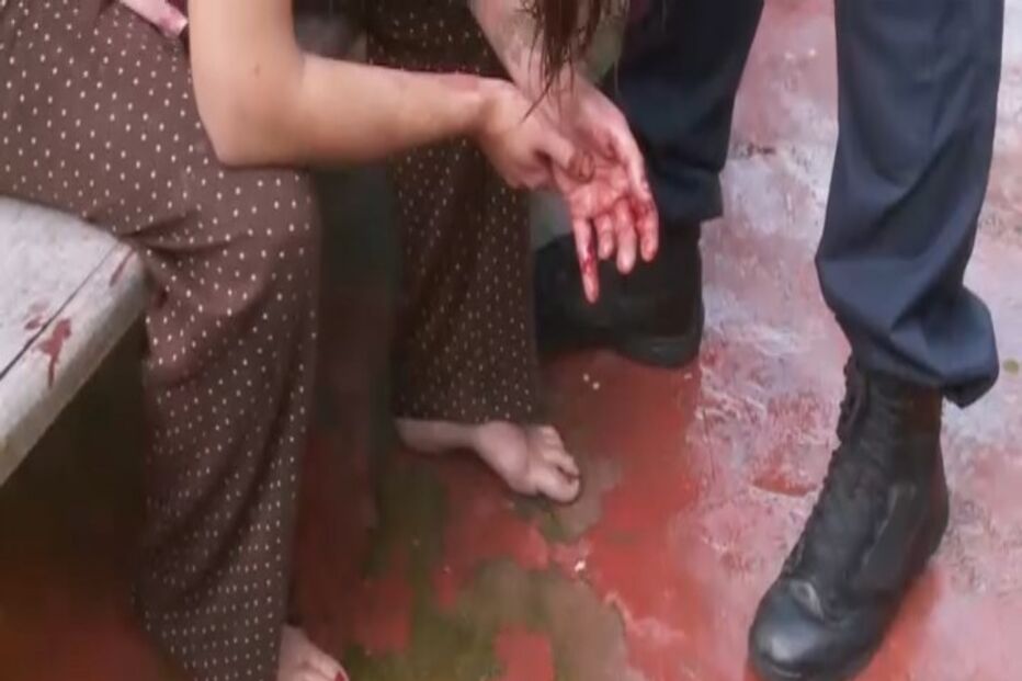 Homem corta pulseira eletrónica e ataca mulher à facada por suspeitar que esta o denunciou