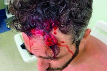 Thiago Rodrigues, assalto, Rio de Janeiro