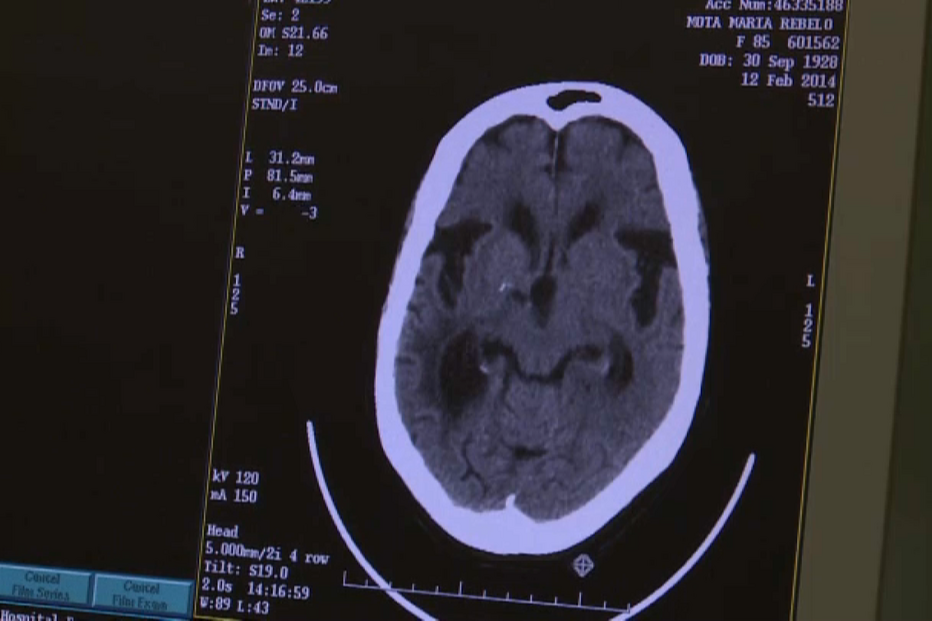 Casos de cancro continuam a crescer em Portugal com maior risco de incidência nos homens