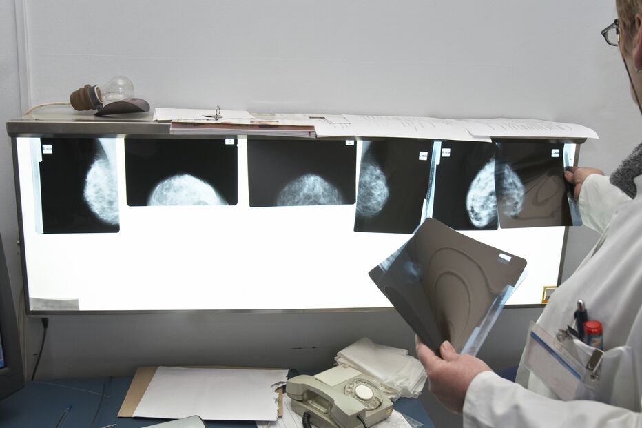 Radiologia, Raio-x, radiografias