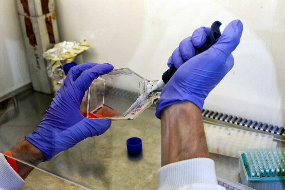 Rastreios vão ser alargados aos cancros do pulmão, próstata e estômago 