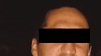 Homem que arrancou nariz de militar da GNR à dentada arrisca perder tutela dos filhos 