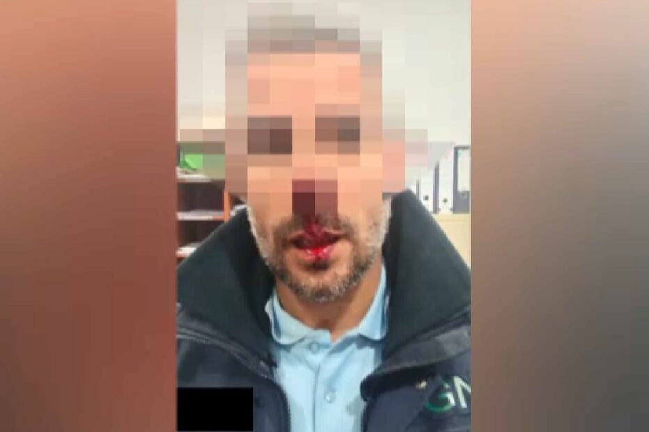 GNR, Beja, agressão, nariz