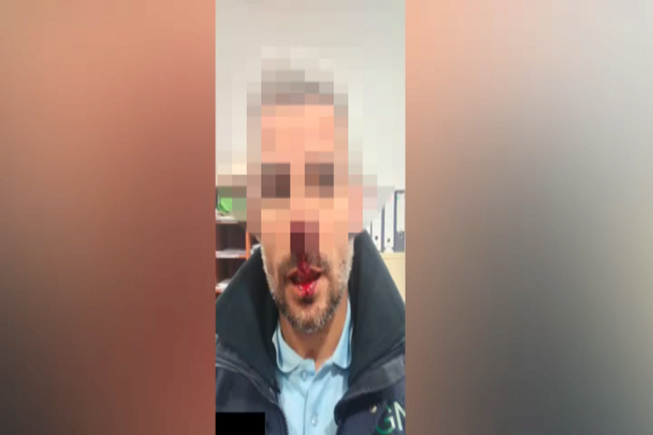 Homem arranca nariz de militar da GNR à dentada em Beja