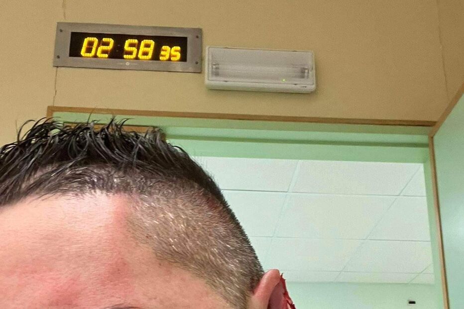 Ricardo Bravo, Lagoa, agressão