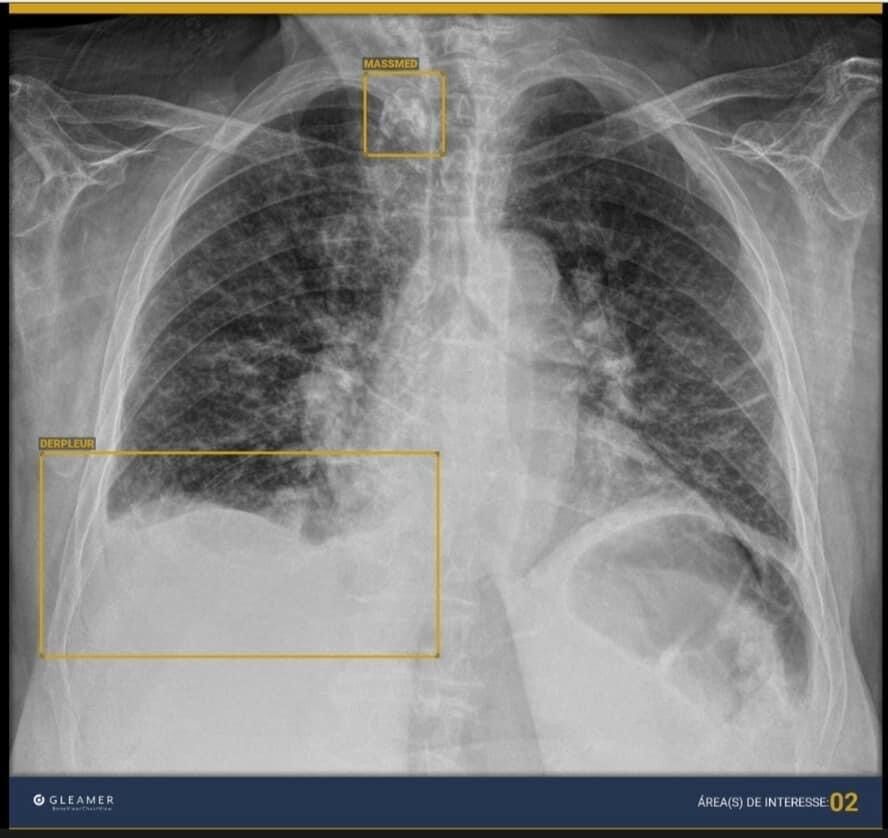 Alentejo Patients Travel Nearly Two Hours for X-Rays
