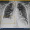<![CDATA[ Utentes percorrem quase duas horas para fazer um raio-x ]]>
