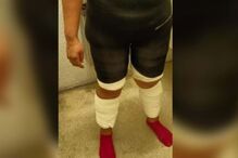 Mulher distribuiu droga  por quatro placas coladas ao corpo com fita adesiva.