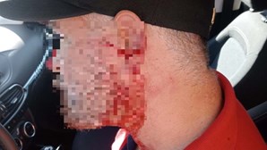 Motorista TVDE esfaqueado por passageiro em Sintra era procurado pela lei 