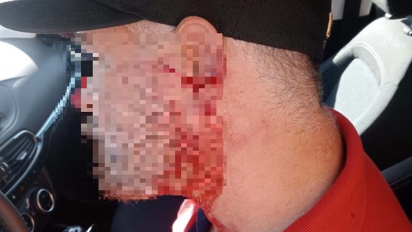 Motorista TVDE esfaqueado por passageiro em Sintra era procurado pela lei 
