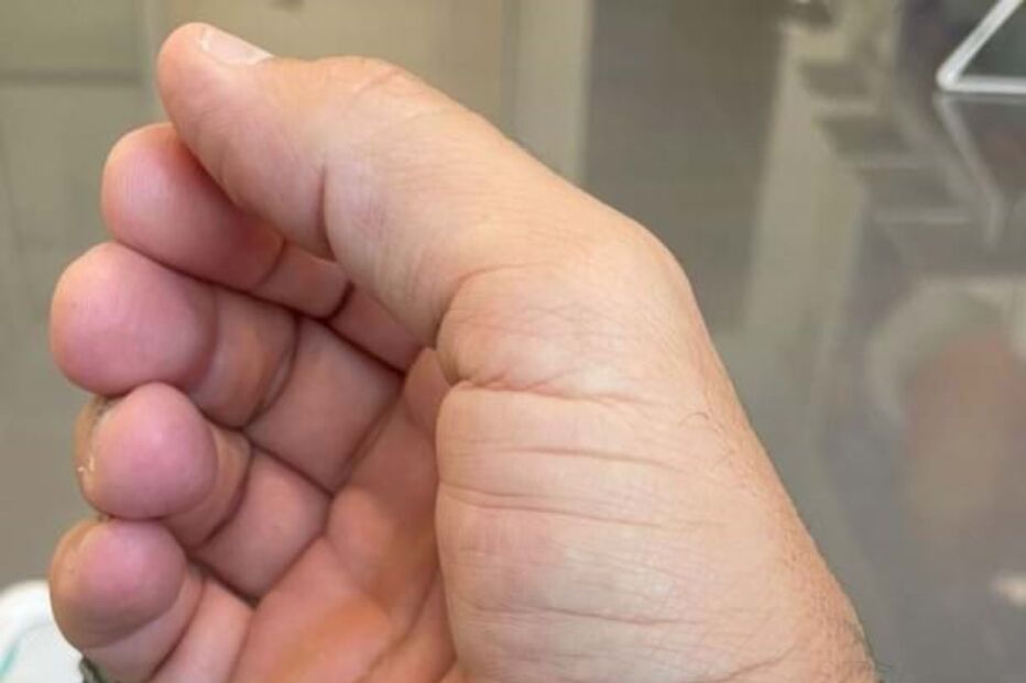 Paulo Battista no hospital