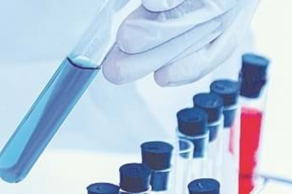 Tubo de ensaio, laboratório