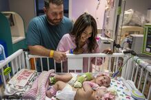 Bebés siamesas unidas pelo abdómen regressam a casa 