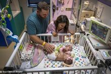 Bebés siamesas unidas pelo abdómen regressam a casa 