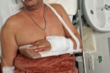 Vítima, de 48 anos, esteve internada seis dias