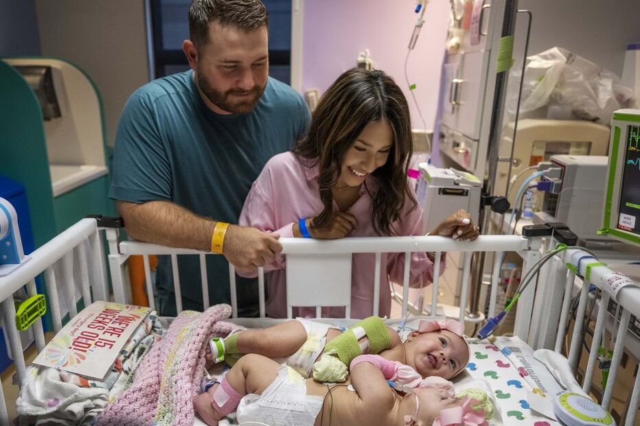 Bebés siamesas unidas pelo abdómen regressam a casa 