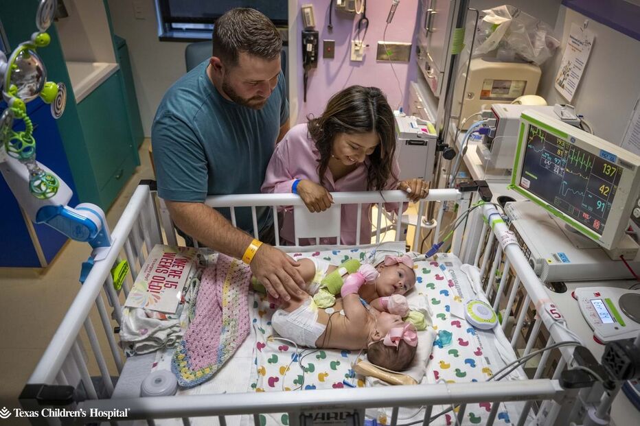 Bebés siamesas unidas pelo abdómen regressam a casa 