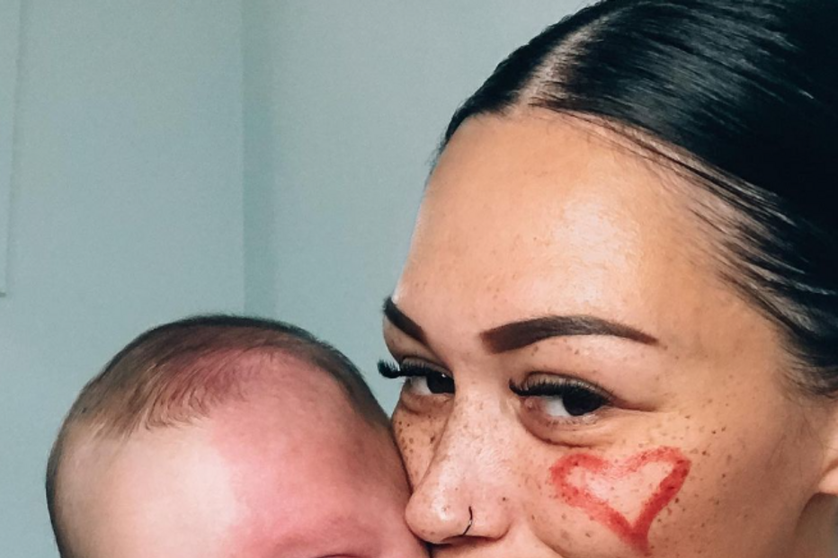 “Monstro”: Mãe é criticada por remover a laser marca de nascença de bebé na Austrália 