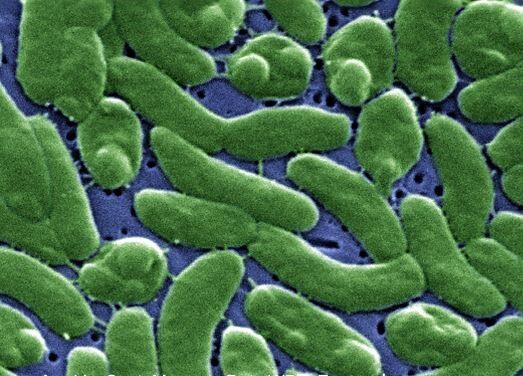 Cyclosporiasis Outbreak Kills Two in Michigan, US
