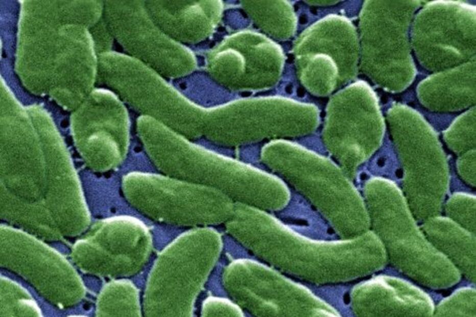 Imagem BACTERIA VIBRIO VULNIFICUS.JPG (18830110) (Milenium)