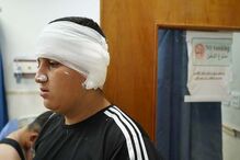 Um dos feridos no incêndio num casamento no Iraque