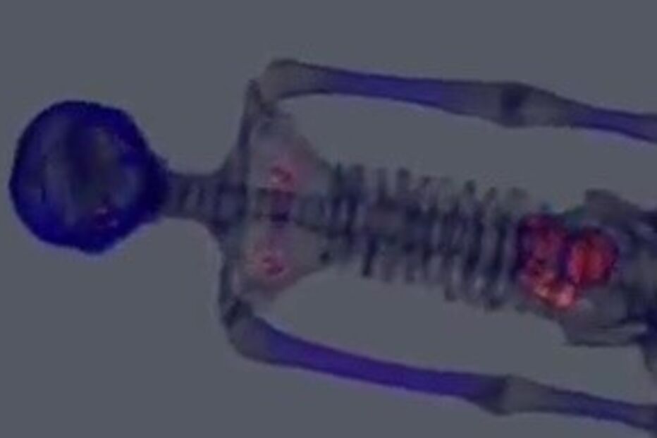 Tomografia detetou ovos no interior do corpo