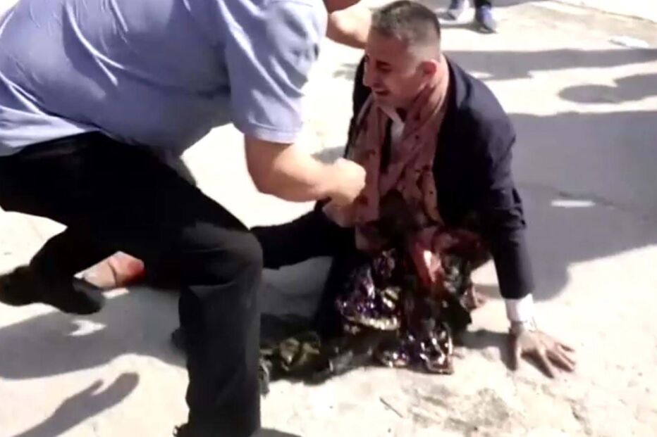 Homem agarra nas roupas carbonizadas da mãe, que não sobreviveu ao incêndio