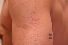 Cláudio Ramos braços