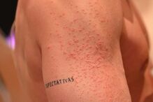 Cláudio Ramos braços