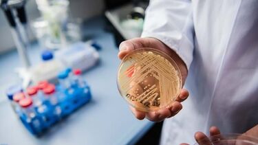 O que precisa de saber sobre o fungo 'Candida auris', considerado uma ameaça à saúde pública global