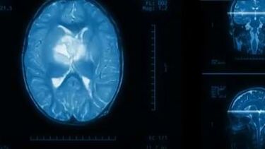 Empresa portuguesa cria solução tecnológica para ajudar a tratar doenças cognitivas