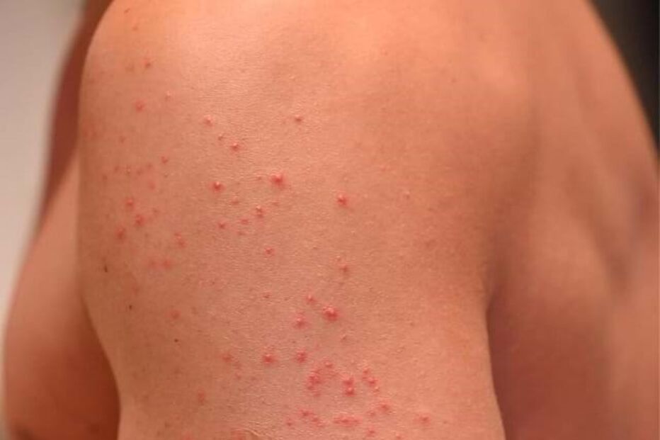 Cláudio Ramos braços