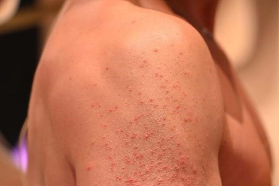 Cláudio Ramos braços