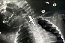 2023-11-14_23_52_18 raiox.jpg