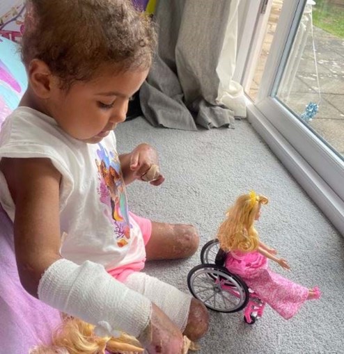 Aiyla perdeu as pernas e cinco dedos devido a uma infeção