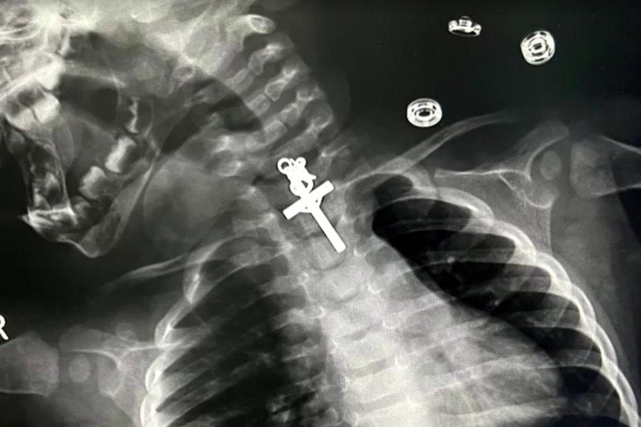 2023-11-14_23_52_18 raiox.jpg