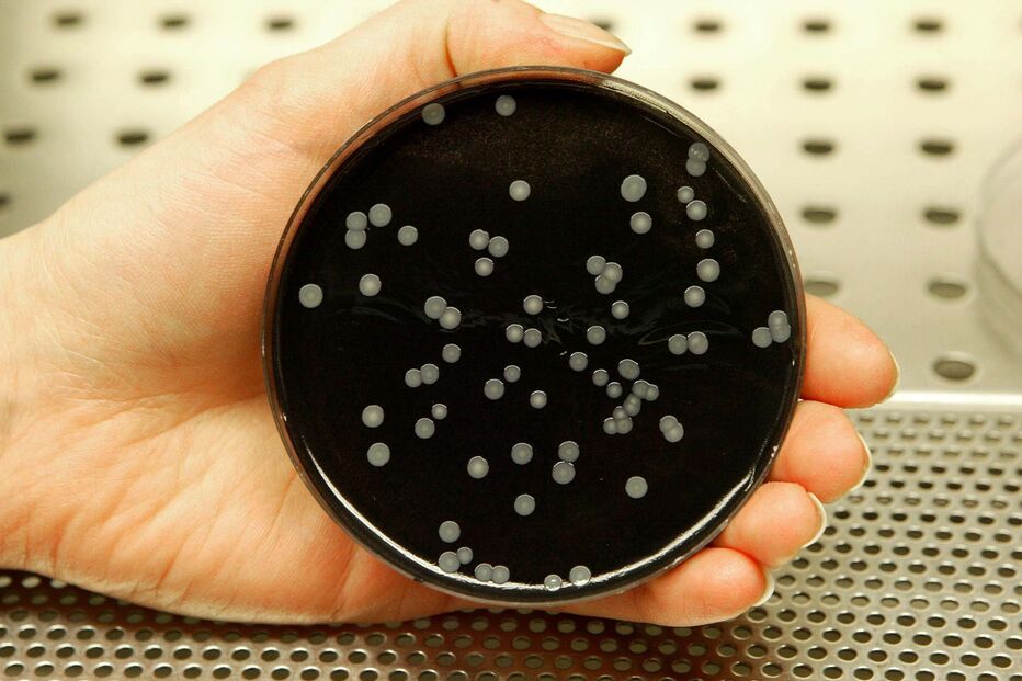Legionella, surto (Imagem genérica)