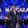 <![CDATA[ João Manzarra fez um branqueamento aos dentes e tudo por causa de Cláudia Vieira ]]>