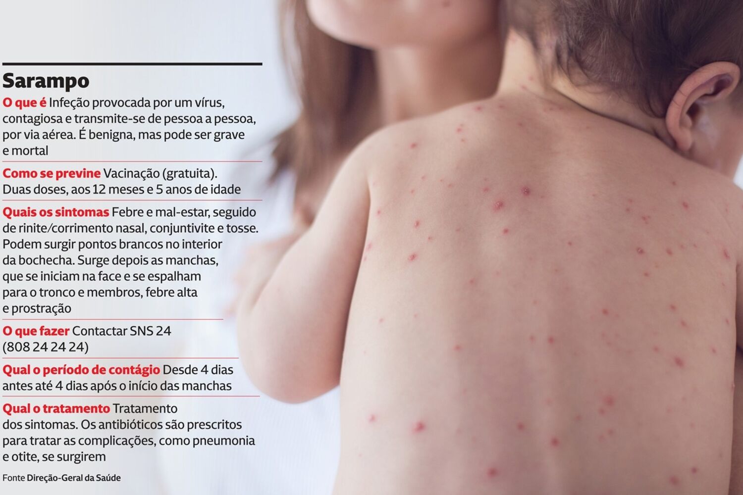 Saiba como prevenir e tratar o sarampo - Infográficos - Correio da Manhã