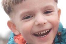 Veles morreu após remover dentes de leite no dentista