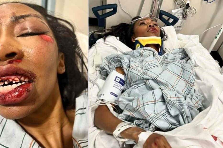 Carrie Bernans desfigurada após atropelamento
