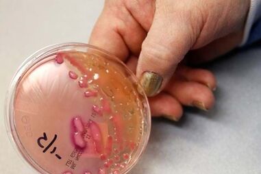 'Klebsiella pneumoniae'