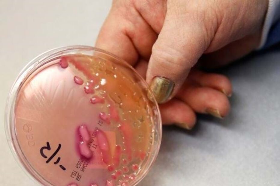 'Klebsiella pneumoniae'