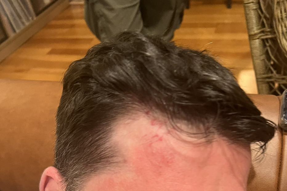 Aliado de Navalny vítima de ataque violento com martelo na Lituânia