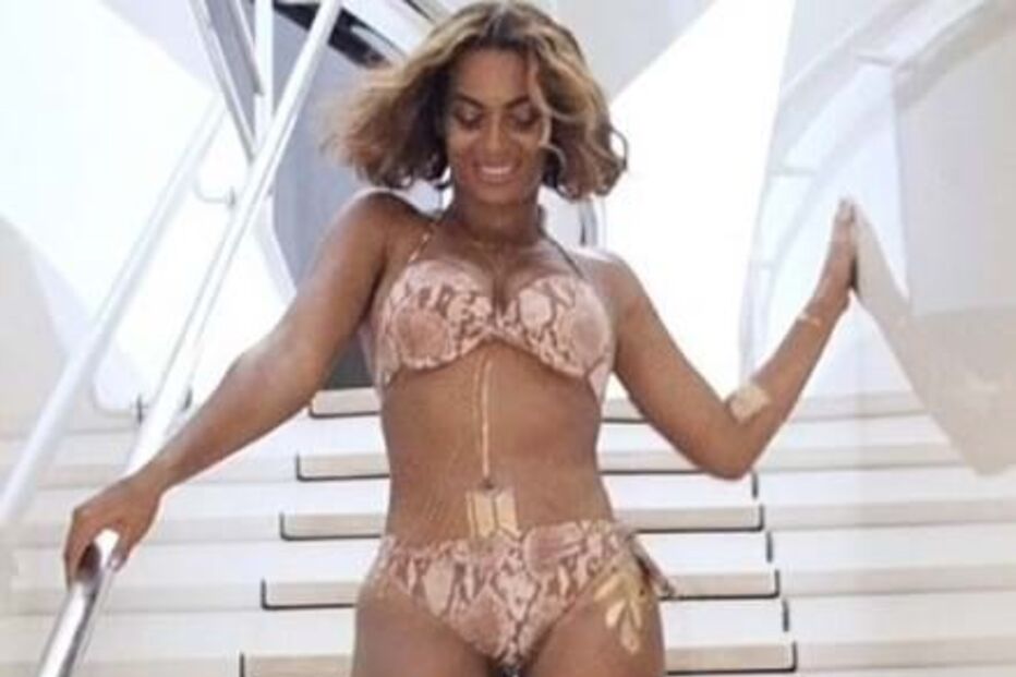 Beyoncé foi acusada de editar espessura das coxas