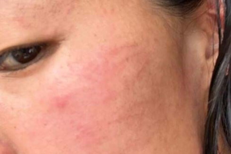 Predador sexual rouba e tenta violar atleta durante treino